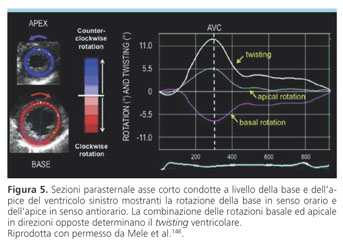 Speckle tracking echocardiography - Wikipedia