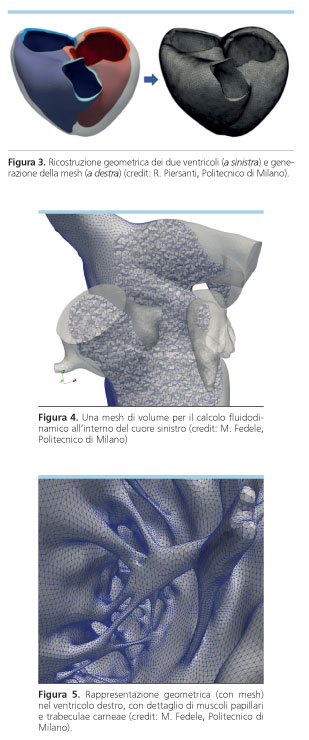 modello cardiaco del solco coronarico