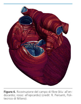 modello cardiaco del solco coronarico