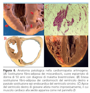 modello cardiaco del solco coronarico