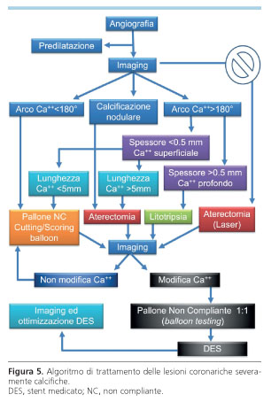 Valutazione E Trattamento Interventistico Delle Lesioni Coronariche Severamente Calcifiche Giornale Italiano Di Cardiologia Organo Ufficiale Di Italian Federation Of Cardiology E Societa Italiana Di Chirurgia Cardiaca