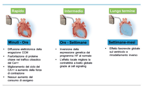 modello cardiaco del solco coronarico