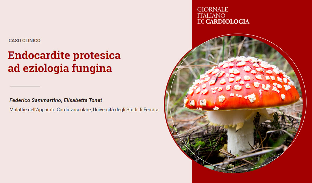 ENDOCARDITE PROTESICA AD EZIOLOGIA FUNGINA